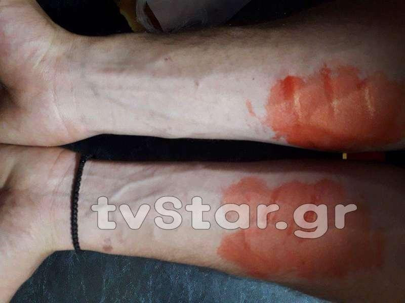 Σκληρή μάχη βοσκού με λύκο στον Παρνασσό – Με νύχια και με δόντια προστάτευε το κοπάδι του (Βίντεο)